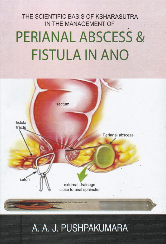 肛門周囲膿瘍および肛門周囲膿瘍の管理におけるクシャラスートラの科学的根拠アノの瘻孔